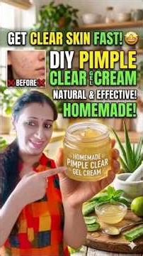 Remove Pimples Naturally in 5 Minutes | DIY Gel Cream #shorts