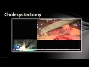 Master Class of Robotic Surgery • Video • MEDtube.net