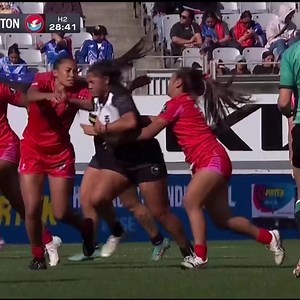 21K views · 111 reactions | Horrible ankle fracture/dislocation for...