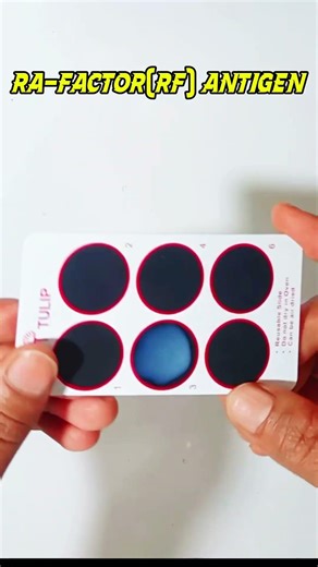 RA- factor test🤯|| how🧐 to check RA- factors #treand #viral #shorts