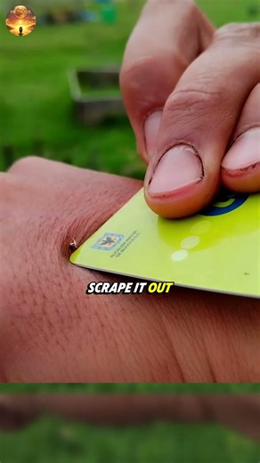 What to Do Immediately After a Bee Sting 😳🐝🧊