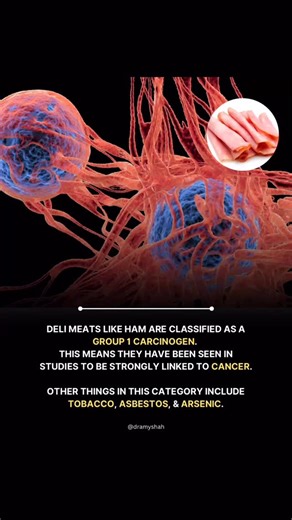 Dr. Amy Shah on Instagram: "Look processed meat are very strongly linked to cancer in medical studies. Of course, an occasional deli ham is not going to kill you and it’s level of toxicity is not close to cigarettes but they are in the same category of class 1 carcinogen. Why? They contain nitrites that can turn into cancer-causing nitrosamines in the body, plus heme iron and high-heat processing that damage the gut and DNA—raising colorectal cancer risk. Limit your consumption"