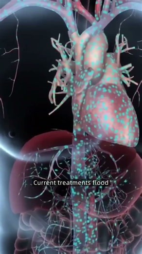 Scientists developed Magnet-guided microbots that deliver stroke-busting drugs right to the clot