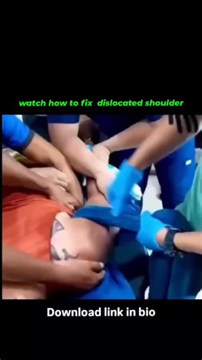 Randeep kumar on Instagram: "🚫 A Shoulder Dislocation Is NOT a DIY Fix A shoulder dislocation is not something you should ever try to “push back” at home. The shoulder is highly mobile, and when it dislocates, it often injures the labrum, joint capsule, nerves, and muscles. ⚠️ Forcing it back can cause: • Nerve damage • Blood vessel injury • Fractures • Permanent instability --- ✅ What To Do Immediately • Keep the arm still and supported • Apply ice to reduce swelling • If there’s numbness, tin