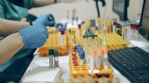 clip-1071009052-many-medical-test-tubes-blood-tests-on