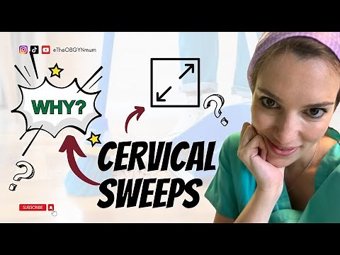 What is a stretch and sweep? Why am I offered a membrane sweep in pregnancy?