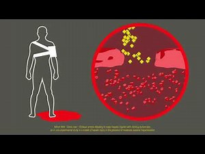 Celox Granules Training Video – Military emergency response (CE regions)