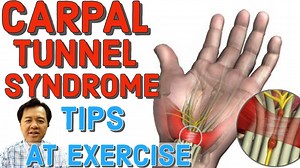 472K views · 9K reactions | Carpal Tunnel Syndrome: Tips at Exercise Tips by Doc Willie Ong (Internist and Cardiologist) Panoorin ang Video: | Doc Liza Ramoso-Ong | Facebook