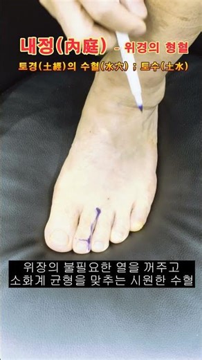 위경의 오수혈(2/5) 형혈(滎穴) : 내정(內庭) [지압신공]