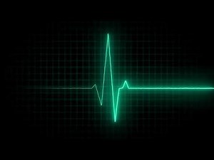 Free motion graphics! EKG Heart beat line pulse footage