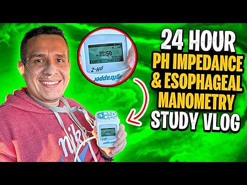 24 Hour Esophageal Impedance pH Test & Esophageal Manometry Study Vlog