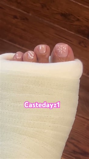Casted toes #legcast #nailart #naildesign #pretty #toes #broken