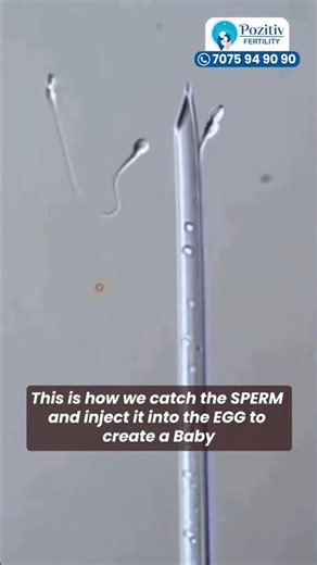 Inside the IVF Lab: How a Baby Is Created in IVF | Pozitiv Fertility | #ivf #icsi