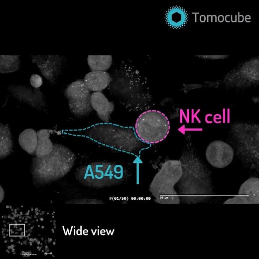 Natural Killer Cell Killing Cancer
