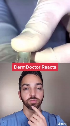 Pore Vacuum Skincare: What You Should Know