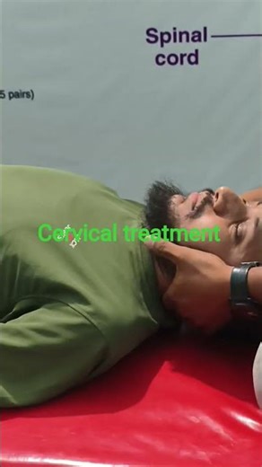 I Got Chiropractic Treatment For My Cervical Dystonia