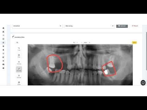 Medhant | Revolutionizing Dental Care with Artificial Intelligence