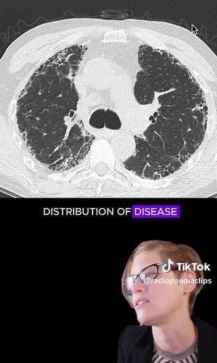 Radiopaedia on TikTok