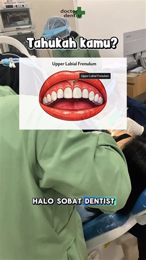 Doctor+Dentist on Instagram: "Udah pakai behel tapi celah gigi depan susah rapat? Ini rahasianya! 🤫 Banyak yang belum tahu kalau celah gigi depan seringkali disebabkan oleh jaringan frenulum (tali bibir) yang terlalu tebal atau rendah. Jaringan ini bertindak seperti penghalang yang “mendorong” gigi tetap renggang. Di Doctor Dentist Palmerah, kita lakukan tindakan Frenectomy untuk membuang jaringan penghambat tersebut. Hasilnya? Celah gigi lebih mudah dirapatkan dan senyum jadi lebih estetik! ✨
