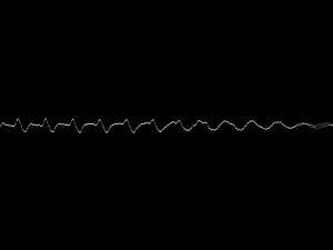 Five limb core construction is preferred over three limb constr... | Filo