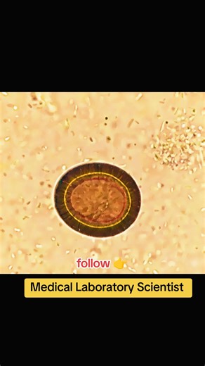 Stool Examination: Identify Parasitic Ova Effectively