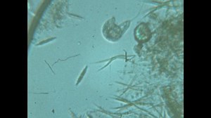 clip-1090894003-1960s-footage-microscopic-organisms