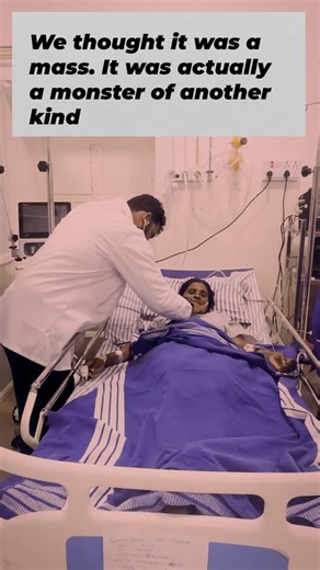 Mohammed Saqlain on Instagram: "Case of the week 🧩 52-year-old female walked in in shock — with fever, cough, and breathlessness. Her X-ray showed a mass-like shadow near the right heart border — suspicious enough to think of neoplasm at first glance. But the HRCT told a different story 👇 ⸻ 🔍 HRCT Findings: 🫁 Dense consolidation + ground-glass opacities in the right lower lobe 🌀 Cylindrical bronchiectasis in middle lobe 💧 Bilateral pleural effusion with atelectasis 🧠 Small mediastinal lym