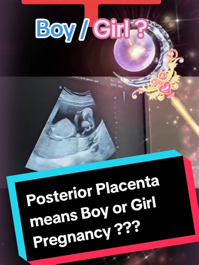 Understanding Posterior Placenta and Baby's Gender