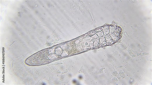 Live active Demodex folliculorum mite moving its legs with visible body structure and internal eggs under 400x brightfield microscopy. Detailed 4k microscopic view