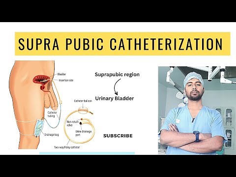 SPC or Supra Pubic Catheterization ||Why need Of SPC |||MedicalEdutech|Urine Drain|Foleys Catheter