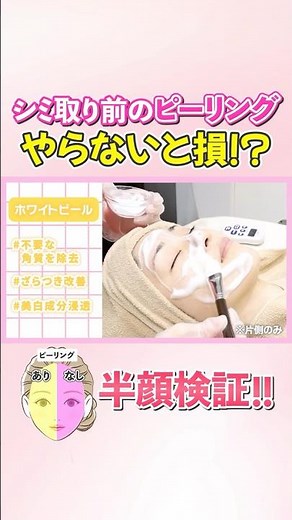 シミ取りの効果を高める方法👀 #切り抜き #品川美容外科 #品川スキンクリニック