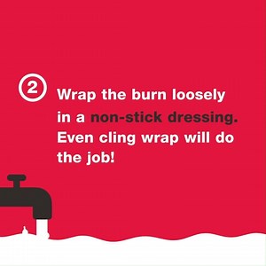 Would you use butter, toothpaste or aloe vera gel on a burn? This World First Aid Day make sure you know fact from fiction. Download the full first aid guide on burns and scalds at www.stjohnnsw.com.au/guides-burns-and-scalds | St John First Aid