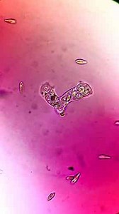 Amoeba Under the Microscope – Strange Shapes and Motion Revealed