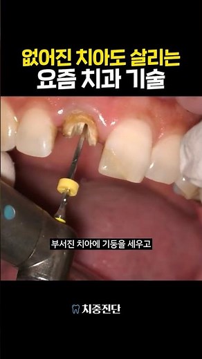 You're saying they can save this?? Modern dental technology even restores missing teeth 🦷