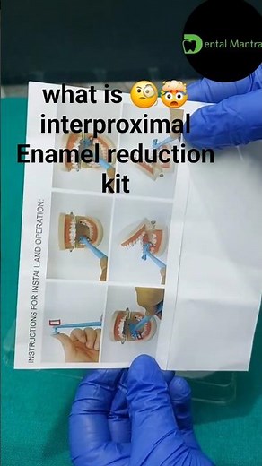 what is 🧐🤯interproximal Enamel reduction kit part -2 #unboxingvideo #dentalproducts #toothenamel