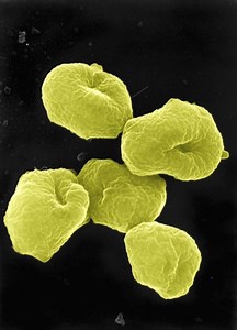 Archaea - Alchetron, The Free Social Encyclopedia