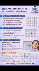 👁️🧩 AMSLER GRID TEST Early Detection of Macular Disease The Amsler Grid Test is a simple and quick test used to check the central vision (macula). It helps detect macular problems early—before vision loss becomes severe. 🔹 What is the Amsler Grid Test? A square grid with a central fixation dot Checks the central 10° of vision Easy to perform in clinic or at home Very useful for regular monitoring. 🔹 Why is this Test Important? Early detection of macular diseases Monitoring Age-Related Macula