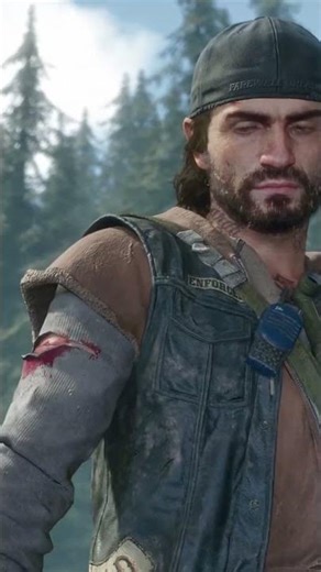 He Bugged Out!! 🤣