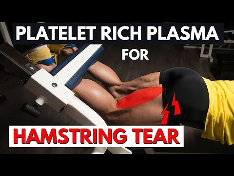 Platelet Rich Plasma For Hamstring Tear | PRP Hamstring Injury