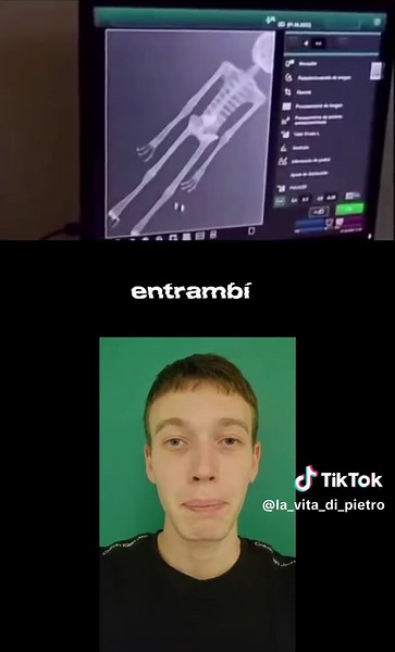 corpi alieni mummificati #CapCut #alieni #ufo #ironia