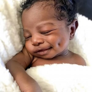 18K views · 1.2K reactions | Strong Baby With Hemangioma | Pretty Babies TV | Facebook