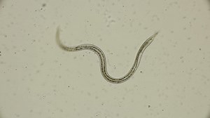 clip-1020587578-roundworm-nematoda-turbatrix-aceti-under-microscope