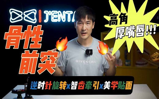 一次性解决门牙磨损、高角骨性前突、下巴后缩、智齿替代坏牙