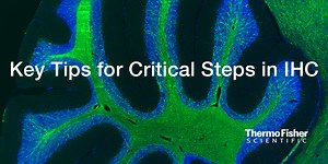 WEBINAR: Five steps for publication-quality immunohistochemistry imaging