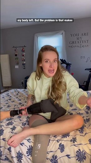 How they decided where to amputate my leg (the "leg chopping" length!)