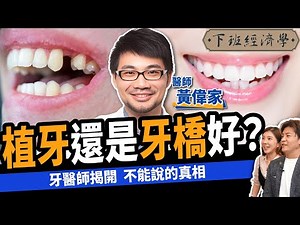 【健康】千萬別急著植牙！名醫揭開不能說的真相：拔牙前3件事不可不知！ft.牙醫師黃偉家｜下班經濟學421｜牙橋