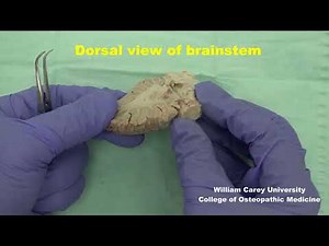 Dorsal and ventral views of the human brainstem; brief study. #neuroanatomy #brainstem#brain
