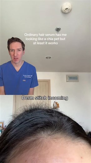 Scott Walter, MD | Dermatologist • Skincare & Hair on Instagram: "Comment HAIR below and I'll DM you the links to this serum from @theordinary Is the viral Ordinary Peptide Hair Serum worth it? Here's what I think! I'd still use topical minoxidil over this any day but I think this could be a good compliment to any hair loss routine for genetic and stress induced hair loss (TE) #hairloss #ordinaryhairserum #alopecia #telogeneffluvium #derm *The content presented in this video is intended for info