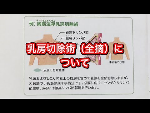 乳房切除術（全摘）について