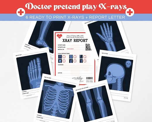 Printable X-rays for Kids: Pretend Play Doctor (PDF) - Etsy